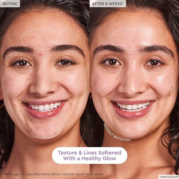 GLOW RECIPE BLACKBERRY RETINOL BLEMISH SERUM - Picture 4 of 7